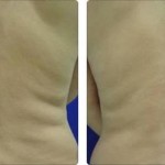 accent-xl-2011-image0291