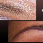 Eyebrows BeforeAfter Eyebrows BeforeAfter